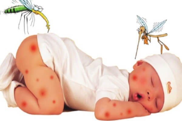 Côn trùng cắn trẻ sơ sinh - Phòng ngừa muỗi, côn trùng đốt hiệu quả