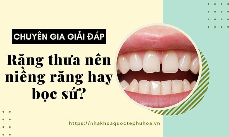 Răng thưa nên niềng hay bọc sứ? - Chuyên gia giải đáp