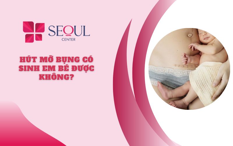 Hút mỡ bụng có sinh em bé được không? - Seoul Center