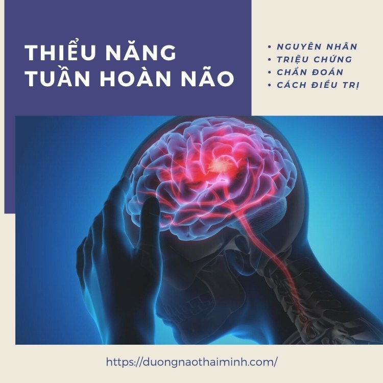 Thiểu năng tuần hoàn não: Từ nguyên nhân đến cách điều trị