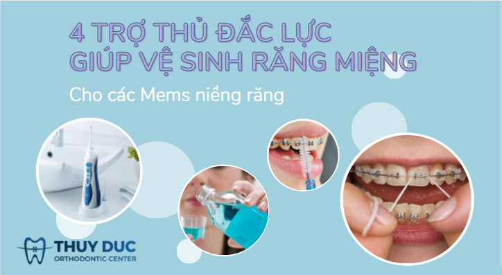 4 trợ thủ giúp bạn vệ sinh răng miệng hiệu quả khi niềng răng