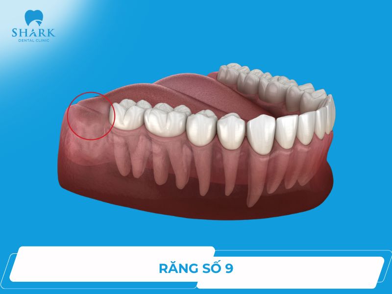 Răng số 9 là răng nào? Nhổ bỏ có nguy hiểm không?